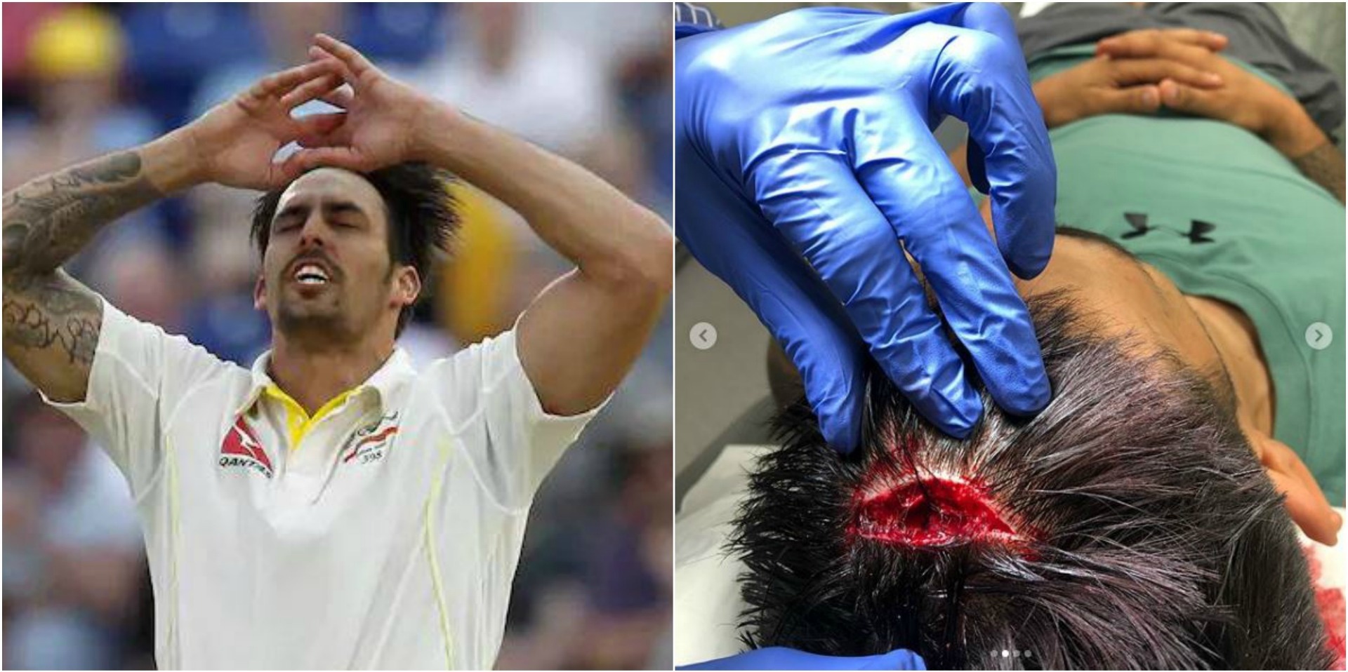 Johnson\'s horrific head injury gives KKR a scare
